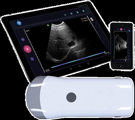 猪用豪润奇全数字背膘仪GY-I